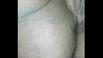 girl2 donkey fuck Gyno injection in man ass medical